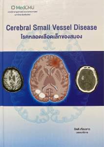 9786163989680 c111 โรคหลอดเลือดเล็กของสมอง (CEREBRAL SMALL VESSEL DISEASE)