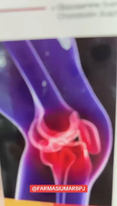 Shine Jointflex Forte | Joint Health
