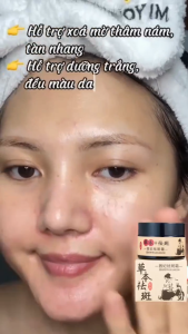Kem Trị Nám Tàn Nhanh Từ Thảo Dược Đông Y Dr.Yunmei - Khử Nám Tàn Nhang Đốm Nâu - Giúp Trắng Da Đều Màu Dưỡng Ẩm Sâu 30gr Nội Địa Trung