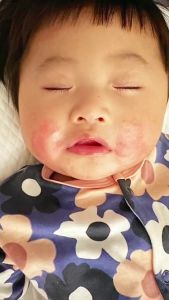 PURELA By REGLOW Soothing Baby Cream - Mengatasi Kulit Ruam pada Bayi dan Anak Biang Keringat