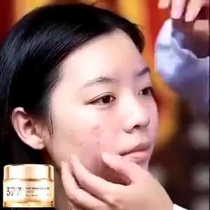 377 Dark Spot Moisturizer 30g Moisturizer Pelembab Wajah Cream Flek Hitam Acne Spot Krim Wajah Pemutih Pencerah Wajah Cream Pemutih Cream Flek Hitam Membandel Krim Penghilang Flek Hitam