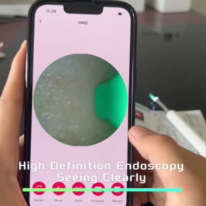 Wireless WiFi Ear Cleaner Intelligent Ear Pick with Camera Visual Ear Scoop Baby Ear Cleaner Ear Spoon