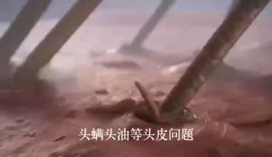 AZLA Hair Shampoo Anti Hair Loss Nourish Hair Oil Control Anti-Dandruff Repair Shampoo Scalp Treatment 500ml