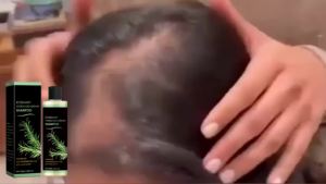 Rosemary Natural Shampoo Hair Thickness Loss Deep Nourishing Scalp Care Strengthen Repair Damaged Oil Control For Men Women