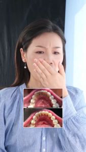 Lets Smile Gold Whitening Toothpaste แพคคู่ ลมหายใจสดชื่น ขาวใส 150g+60g+10g