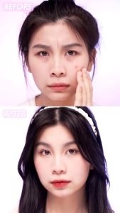 BPOM FOCALLURE Day/Night Spot Patch Acne Treatment Skin Care Acne Repair