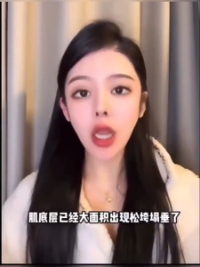 CHOMA กระชับแก้มสาย สายรัดหน้าเรียว แรงกระชับสบาย ระบายอากาศได้ดีสามารถใส่ได้ทุกช่วงเวลา ใส่สบายไม่เจ็บหน้า