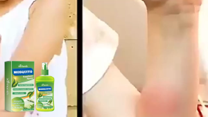 【Ready Stock】Ximonth Mosquito Repellent Spray 100ml – Plant-Based Bug Spray for Kids & Adults DEET-Free Herbal Insect Repellent Long-Lasting Outdoor Protection