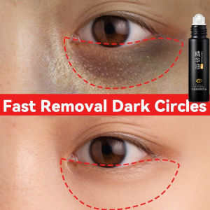 Eye cream for dark circle and eyebag Eye cream serum collagen anti wrinkle and aging Dark circle remover Herbal Essence Eye care remover fat particles