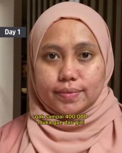 Lume Hydro Essence Facial Cleanser Radiant Starter Set Lumecolors