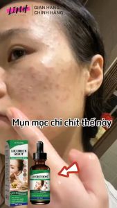 Tinh chất đánh bay mụn nám Jaysuing 30ml giúp tái tạo da mặt làm sáng và căng bóng da ngăn ngừa lão hóa dachống thâm mắt và bọng mắt một cách hiệu quả Tinh chất chống lão hóa chống nhăn căng bóng da ngừa nám tàn nhang