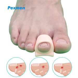 Pexmen 2/4Pcs Hammertoe Corrector Toe Splints Realign Bent Curled Claw Hammer Toes Toe Straighteners for Men and Women
