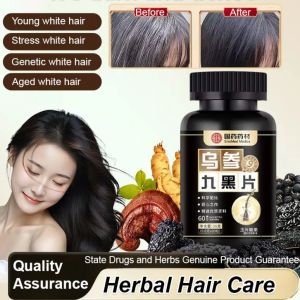 [White Hair Turns Black] Herbal Extracts From Wushen Tablets Are Brewed Nourish The Scalp Hair Care Black Hair Tablets Hair Strengthening Anti-hair Loss Health Care Products Nourishing Scalp