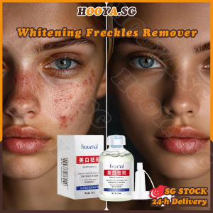 ✅SG stock✅ Dark spot serum / Niacinamide Anti freckles serum / Melasma whitening serum face brightening / Freckles remover / 美白祛斑