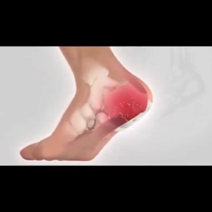 足跟痛贴Heel Pain Patch Relieves Heel Pain Plantar Fasciitis 12 patches/box Knee Joint Pain Patch