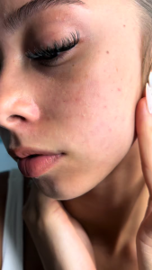 Kopher Curepair Mela Cream (35ml)