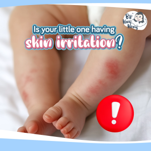 BB King Kong California Baby No Fragrance Super Sensitive Calendula Cream 14g/51g 100% Plant-Based/senstivie/baby skincare/newborn/moisturizer/dryskin