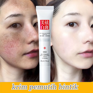 【100% Original】Whitening Freckle Cream 20G Anti Freckle Cream Niacinamide Fade Pigmentation Melasma and bintik-bintik Brighten Creams Hydrating / Pemutihan Yang Efektif Bintik Cream Menghapus Melasma Jerawat / For all skin types