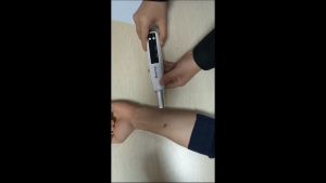 Ready Picosecond Laser Pen Dark Spot Tattoo Mouse Scar laser tattoo removal laser cleaning machine whitening 祛疤 去纹身