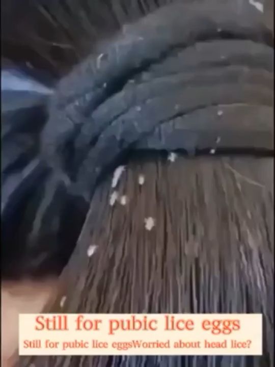 [Quick results in 5 minutes] lice removal shampoo for kids free shower cap grate comb kuto and