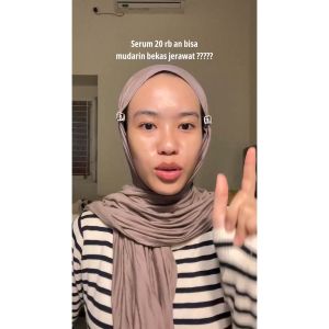 Hanasui Power Post Acne Serum - Pudarkan Bekas Jerawat PIE & PIH Mencerahkan dan Kurangi Kemerahan Cegah Jerawat Kembali