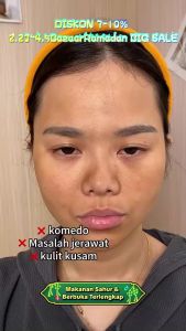 GMEELAN 2PCS Set 1 Minute Exfoliating Gel 50g + Pencerah Wajah Lazy Cream 30g