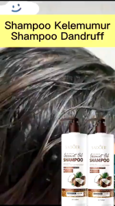 Anti Dandruff Shampoo Dandruff Scalp Treatment Oily Scalp Shampoo Coconut Shampoo Itchy Scalp Shampoo Anti Itch Anti Frizz Shampoo Seborrheic Dermatitis 头皮屑 洗發水