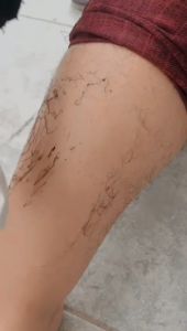 Perontok Bulu Spray Penghilang Bulu Miss V Waxing Bulu Perontok Bulu Kaki Tangan Terbaik Sampai ke Akarnya - Cepat Aman dan Tanpa Rasa Sakit Mudah Meresap ke Dalam Kulit - Tanpa Resiko Kulit Terluka Seperti Saat Menggunakan Pisau Cukur