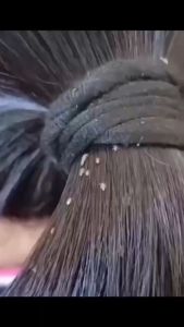 จัดส่งฟรี!✨✨✨กําจัดเหาทั้งหมด ยาฆ่าเหา ไข่เหาสำหรับเด็ก ฟรีหวีสางเหา กําจัดเหาและไข่เหา จากสมุนไพร เหมาะสําหรับเด็กและหญิงตั้งครรภ์【สระผมก็กำจัดเหาได้】เหาหายไป！ใช้ได้ปลอดภัยทั้งเด็กและผู้ใหญ่ บรรเทาอาการคัน ยาฆ่าเหาถาวร