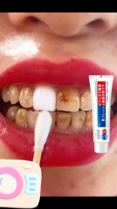 Whitening toothpaste Probiotic Toothpaste 美白牙膏 110g fresh breath removes tooth stains Relieve toothache remove smoke stains