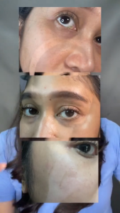 Reglow Advanced Hydration Facial Foam Sensitive - 100ml | Sabun Cuci Muka dengan 8x Ceramide Menenangkan Kulit Mmbersihkan Wajah & Memperbaiki Skin Barrier