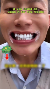 LYDIMOON Probiotic Whitening Toothpaste 120g Remove Yellow Smoke Stains Tartar Bad Breath Fresh Jasmine Breath Oral Care Repair Gum Prevent Tooth Decay Deep Clean Teeth Stain Remover