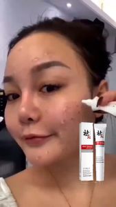 Whitening Freckle Cream krim penghilang flek hitam Whitening Blemish Flek Hitam BPOM Krim Pemutih Penghilang Bintik Wajah Krim Asli Efektif Menghilangkan Bintik Hitam
