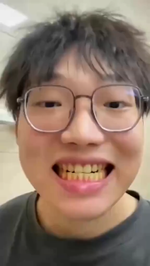 Gel Nano Bạc Đánh Tan Cao Răng Sạch Mảng Bám Trắng Răng GAOLIBAI - Loại Bỏ Mảng Bám Cao Răng