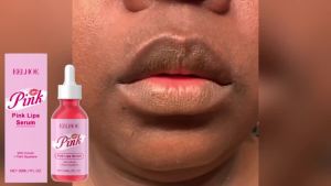 Pink Lip Serum Lightening Pink Lips Darkness Removal Dead Skin Remover Gloss Lip Plumping Dead Skin Remover Lip Exfoliator Serum