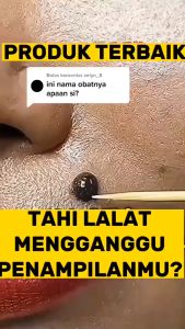 Lotion 𝐏𝐄𝐍𝐆𝐇𝐈𝐋𝐀𝐍𝐆 𝐊𝐔𝐓𝐈𝐋 / Penghilang Tahi Lalat / Swiss Paris Lotion