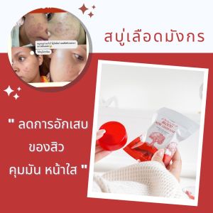 ราคาที่ถูกต้อง 60g ของสบู่ลดสิ ว สูตรออร์แกนิค สบู่เลือดมังกร ของ PL Skincare