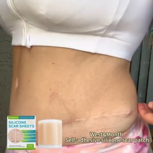 EELHOE 1 Roll Silicone Scar Sheets Skin Repair Patch Removal Self-Adhesive Stretch Mark Tape Therapy Patch Burn Acne Scar Skin Care 4*150CM