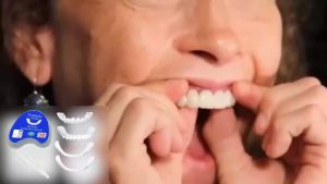10Pairs Snap-On Dental Veneers Kit 10Top+10Bottom Non-Toxic Natural-Look for Broken Missing Teeth