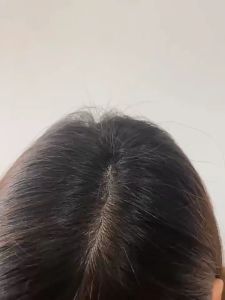 พร้อมส่ง ผงปิดหัวล้าน ผงไฟเบอร์สีดำ Toppik โรยผมเพื่อเพิ่มผมหนา ปิดผมบาง ปิดหงอก ปิดรอยแสกกว้าง ทำให้ผมดูหนาขึ้นทันที ผมบาง หัวเถิก หัวล้าน สูตรติดทนนาน SK Rạb ngein ส่งจาก กทม