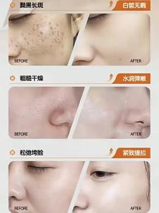 CKCU | Mặt Nạ Dưỡng Ẩm Làm Trắng Sáng Tone Da Mờ Các Vết Đen