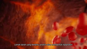 Obat Penyakit Jantung Ampuh BPOM PAKET 2 BOX RETLIFA BHARATA