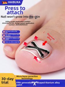 In-growing Toenail Correction Stickers