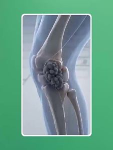 WMO | Knee Massage Device for Therapeutic Heat and Warmth Suitable for Seniors