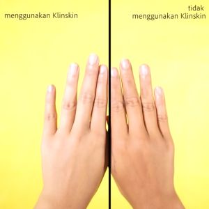 Klinskin Klin Skin Beauty Soap 100gr Asli Original Bpom Sabun Collagen Cuci Muka Pemutih Mencerahkan Wajah Glowing Dan Badan