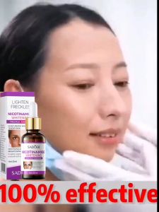 SADOER Freckle Serum Cream Remove Dark Spots on Face Melasma and Pekas Remover Original Pekas Remover Cream Original Dark Spot Remover Retinol Cream Original for Melasma Remover Anti Melasma Remover Cream Freckle Cream Whitening Facial Skin Care Cream