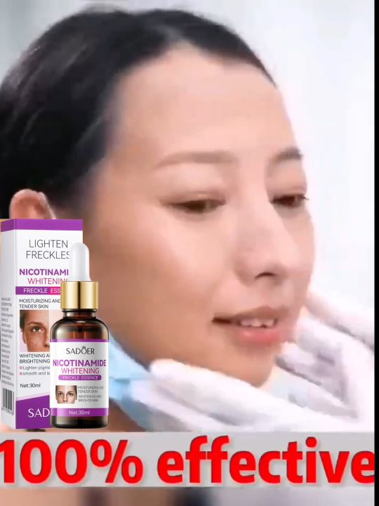 SADOER Freckle Serum Cream Remove Dark Spots on Face Melasma and Pekas Remover Original Pekas Remover Cream Original Dark Spot Remover Retinol Cream Original for Melasma Remover Anti Melasma Remover Cream Freckle Cream Whitening Facial Skin Care Cream