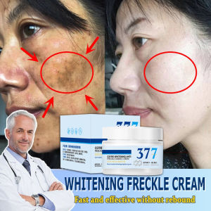 Dinkiss 377 Cream Whitening Freckle Remover Cream 50ml Melasma Removal Cream Original Nicotinamide Brighten The Skin Dark Spots Remover Cream 377淡斑美白面霜正品
