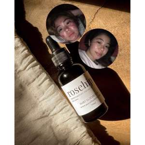 Mary Elizabeth R Rosehip Moisturizing Facial Oil for Scars and Dark Spots - Hydration and Brightening