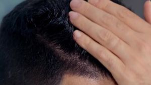 ALIKA Natural Shampoo And Serum Set Hair Growth For Men Grow Gorgeous Hair Growth Hair Loss Treatments Suitable For Dry Oily Normal Scalp